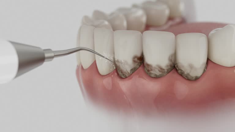 Reliable Dental Implants contractor in Kaser, NY by Smile Center Dentistry